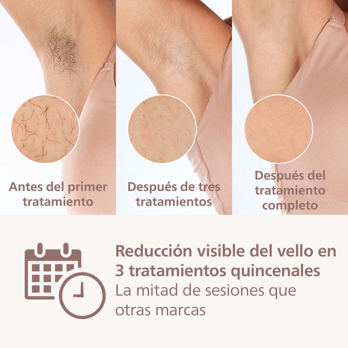 Depiladora Laser IPL Philips BRI947/00 Lumea Prestige